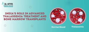 Thalassemia treatment in India